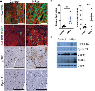 HRas and Myc synergistically induce cell cycle progression and apoptosis of murine cardiomyocytes